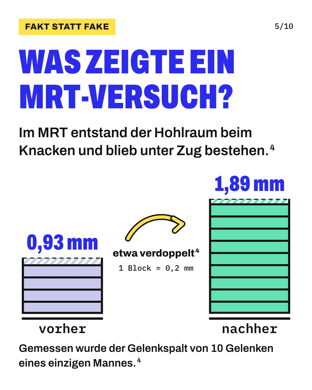 Slide 5: Was zeigte ein MRT-Versuch? Im MRT entstand der Hohlraum beim Knacken und blieb unter Zug bestehen. Die Grafik zeigt 2 Türme aus Blöcken, 1 Block steht für 0,2 mm. Im MRT war der Gelenkspalt unmittelbar vor dem Knacken durchschnittlich 0,93 mm weit, das sind 4,65 Blöcke; unmittelbar danach 1,89 mm, das sind 9,45 Blöcke. Der Spalt hat sich etwa verdoppelt. Gemessen wurde an 10 Fingergrundgelenken eines einzigen Mannes. Gemessen wurde der Gelenkspalt von 10 Gelenken eines einzigen Mannes.