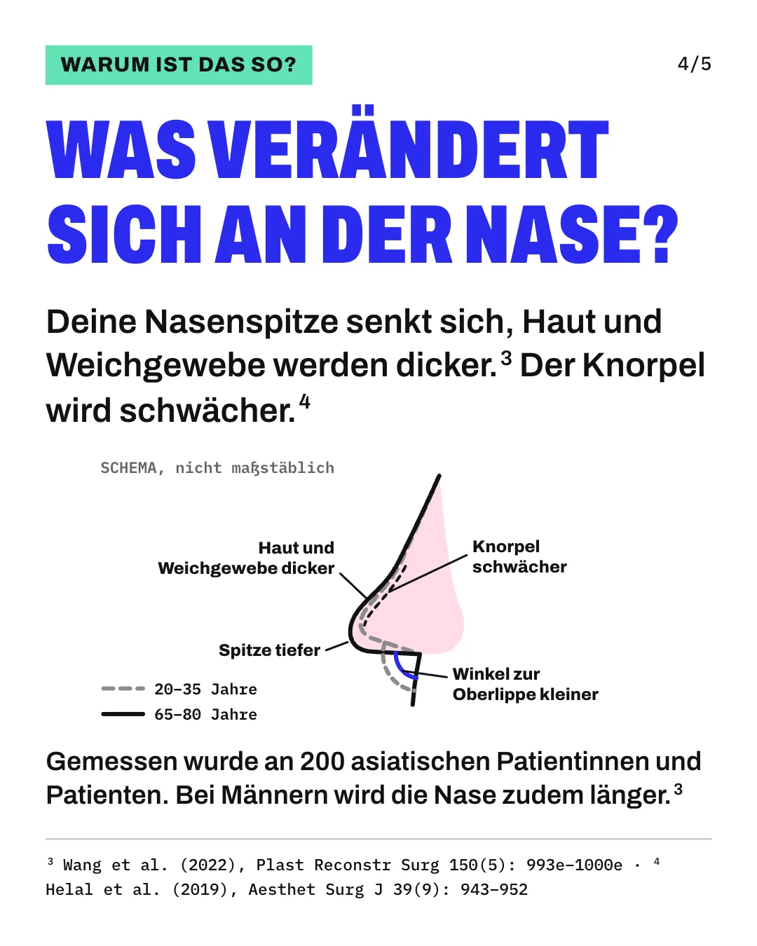 Slide 4: Was verändert sich an der Nase? Deine Nasenspitze senkt sich, Haut und Weichgewebe werden dicker. Der Knorpel wird schwächer. Die Schemagrafik zeigt 2 Nasenprofile, ein gestricheltes für das Alter von 20 bis 35 Jahren und ein durchgezogenes für das Alter von 65 bis 80 Jahren. Die ältere Nasenspitze sitzt tiefer, der Winkel zur Oberlippe ist kleiner, und Haut und Weichgewebe sind dicker. Eine gestrichelte Innenlinie markiert den Knorpel, der schwächer wird. Gemessen wurde an 200 asiatischen Patientinnen und Patienten. Bei Männern wird die Nase zudem länger.